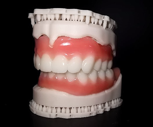 DH Congenital Anodontia Case Study - Dental Prostheses