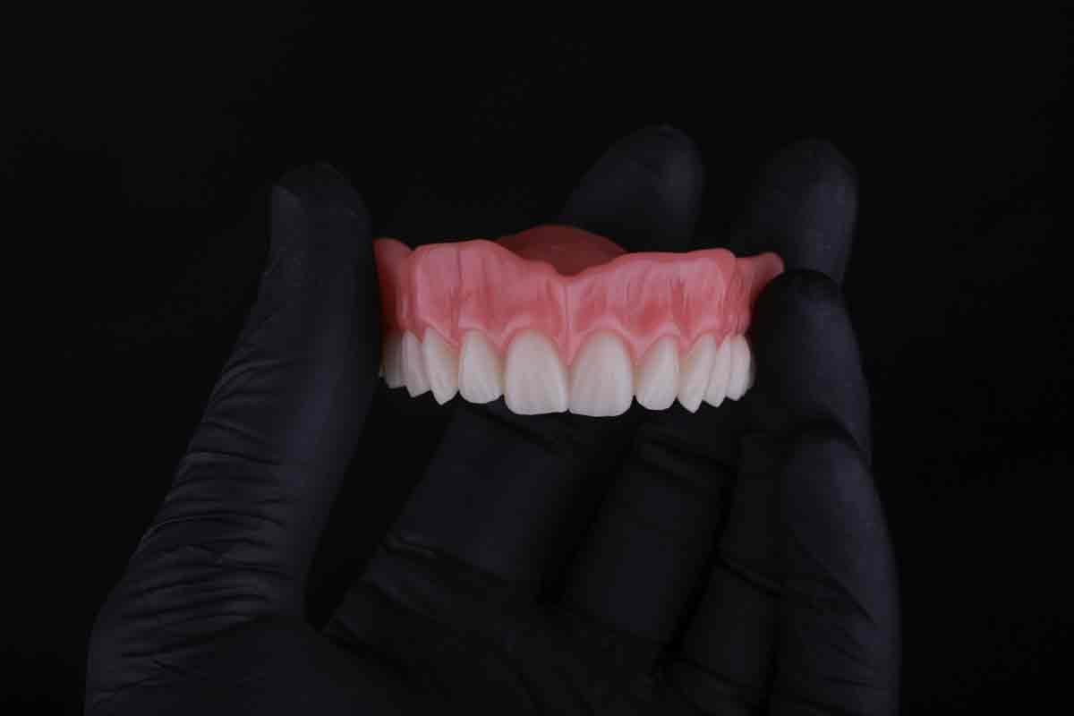 Jacks-Denture1